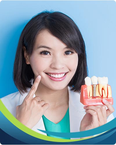 Dental Implants Near Me in San Jose, CA