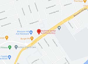Directions From Your Location to NuSmile Dental & Orthodontics in San Jose, CA
