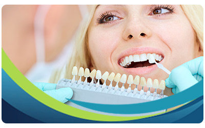 Porcelain Veneers Specialist Near Me in San Jose, CA