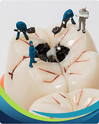 Dental Sealants Near Me in San Jose, CA