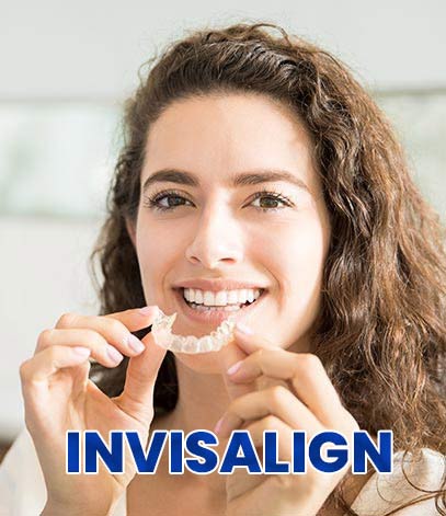 Invisalign Treatment Near Me in San Jose CA