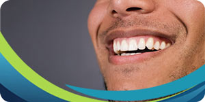 Dental Veneers vs. Braces Near Me in San Jose CA