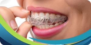 Top Invisalign Dentist Near Me in San Jose CA, Blossom Hill Rd